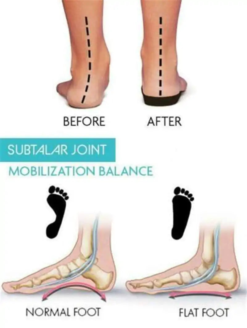 Bunnion Corrector 1