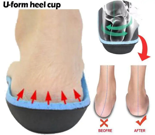 Load image into Gallery viewer, Premium Orthopedic Insoles
