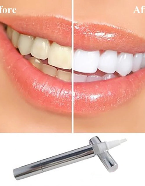 Load image into Gallery viewer, Flawless Teeth Whitening Pen
