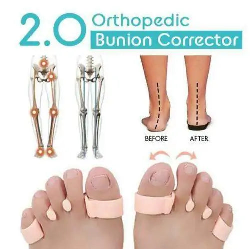 Bunnion Corrector 1