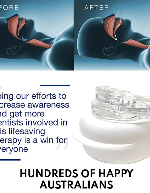 Load image into Gallery viewer, Anti-Snoring Mouthpiece
